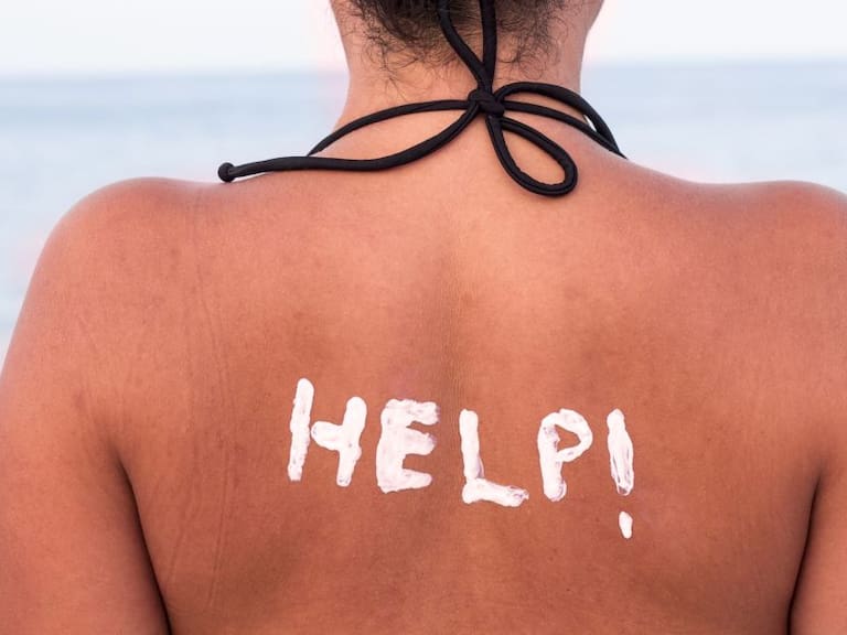 Cuidados de la piel por el sol en la playa ¡Sigue tips!