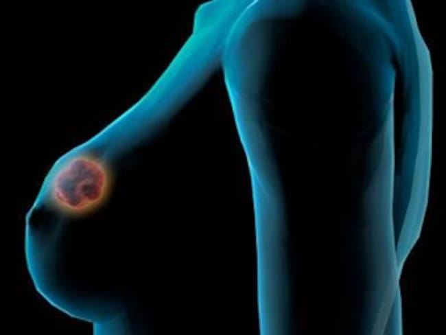 Investigadores japoneses presentan aparato para detectar cáncer de mama