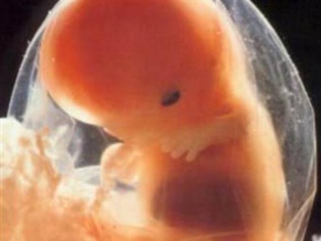 Pasó de 38.5 a 73% aceptación del aborto en DF