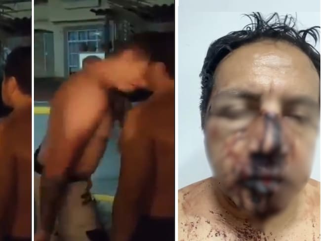 Paco Granillo, exreportero de TV Azteca fue brutalmente golpeado en su casa en Morelos