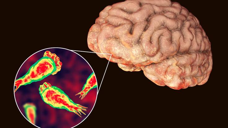 Ameba come cerebros Yucatán: qué es, cómo se contagia y cuáles son sus síntomas