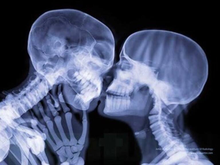 Estos rayos X cambiarán tu forma de ver el cuerpo y el mundo