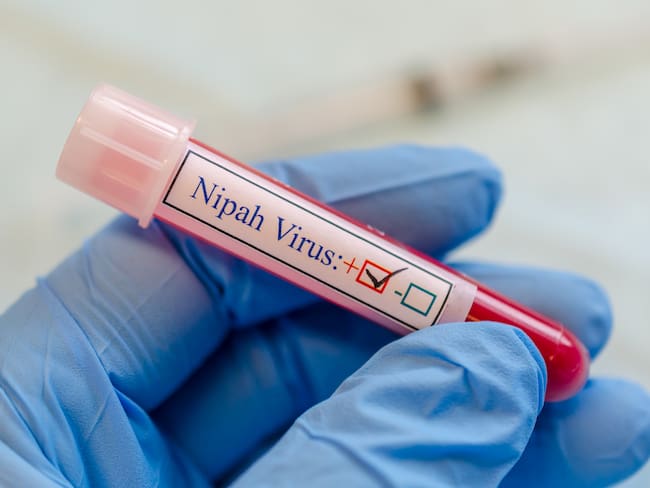 ¿Qué es el virus Nipah y cómo podría afectar a México?