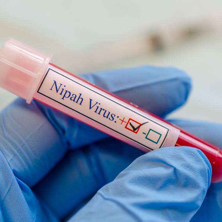 ¿Qué es el virus Nipah y cómo podría afectar a México?