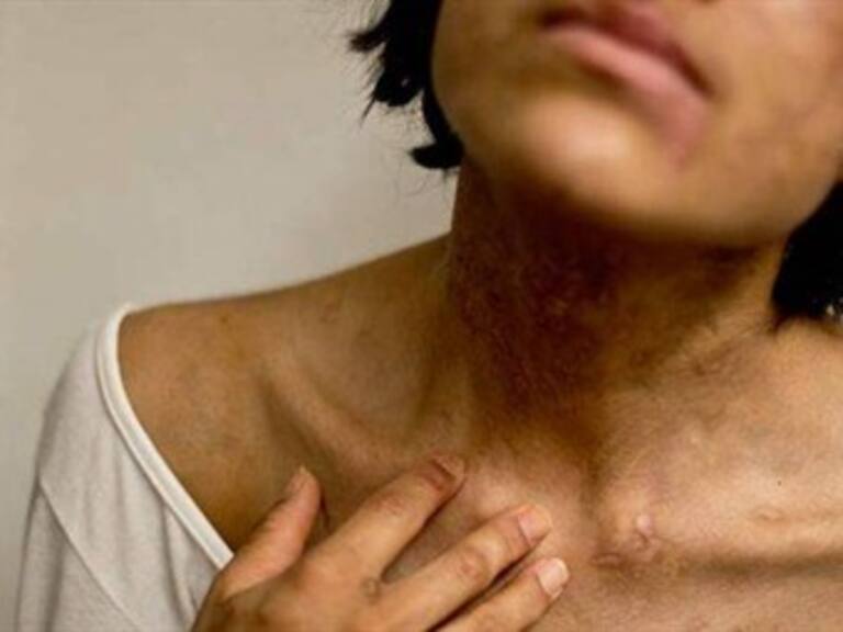 Buscan cirujano para reconstruir rostro de joven esclavizada