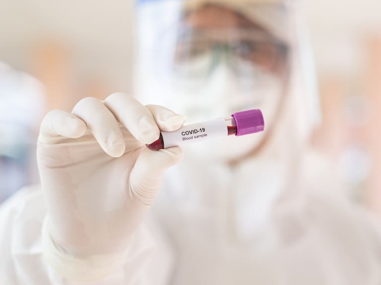 Examen detección de coronavirus desde seis mil pesos; Hospital Ángeles