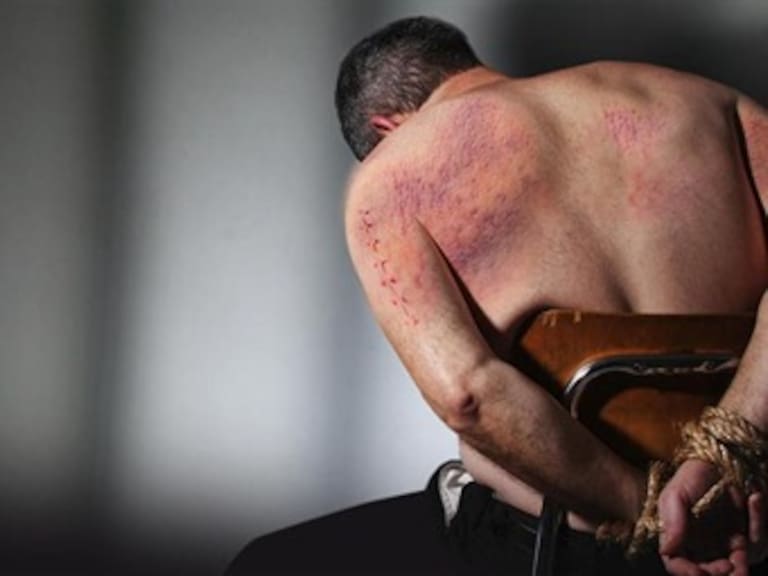 Tortura y malos tratos en la detención son generalizados: ONU