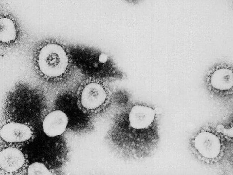 Reportan primer caso de coronavirus entre humanos dentro de EU y Francia