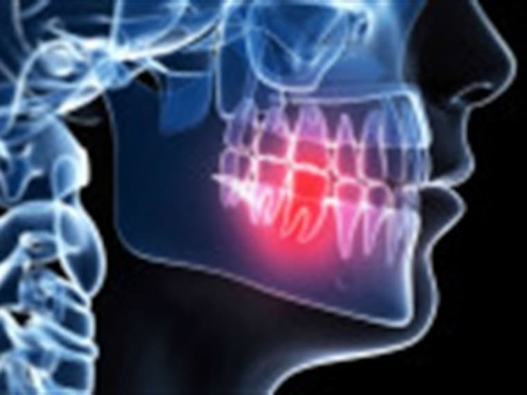¿Qué te hace un dentista en la terrorífica endodoncia?