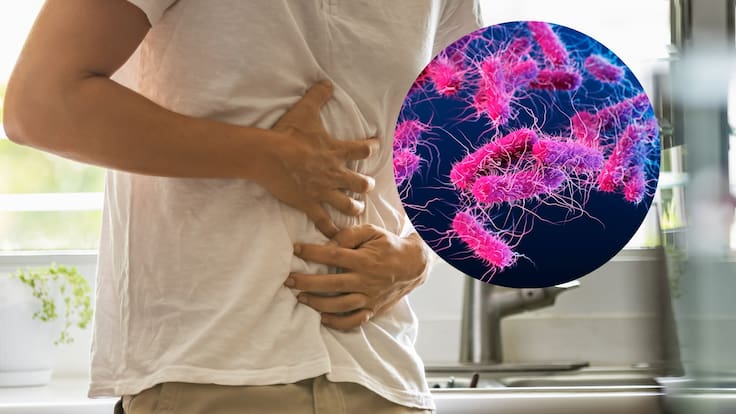 Brote de Salmonella en médicos del Hospital General: síntomas, tratamiento y cuánto dura la infección