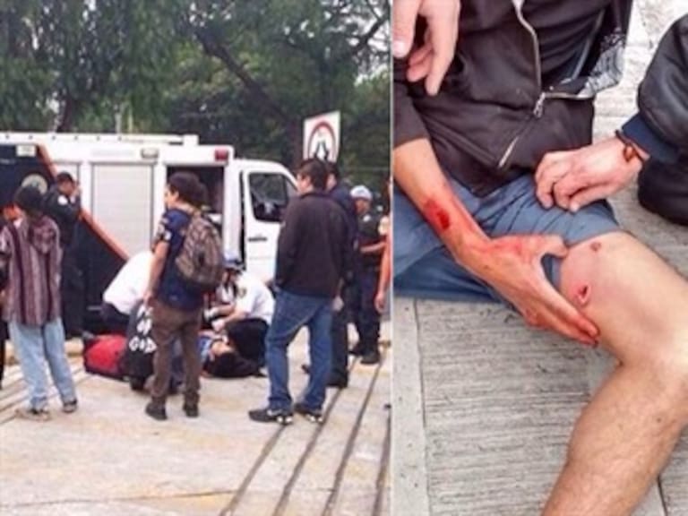 Exige PRD castigo ejemplar para policía que lesionó a estudiante de la UNAM