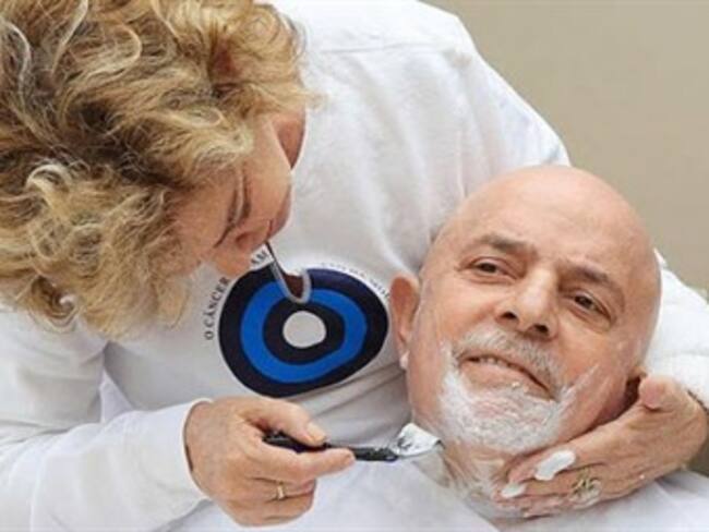 Cambia imagen Lula ante tratamiento contra el cáncer