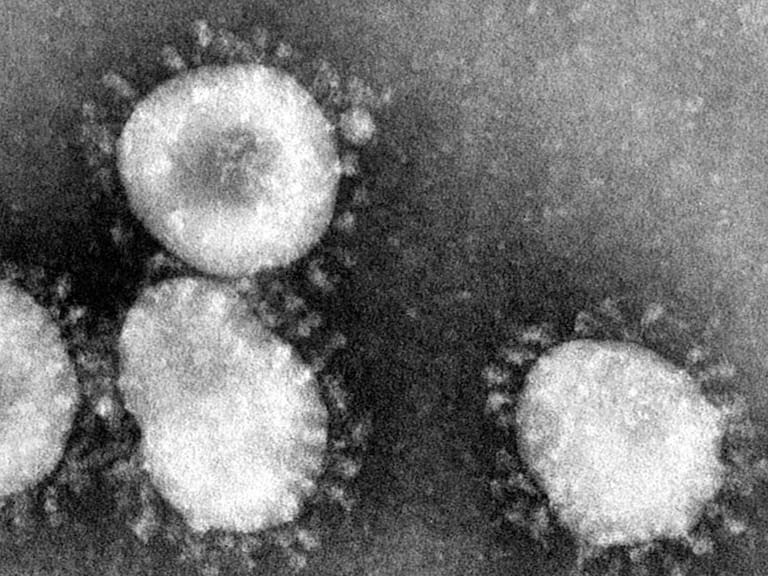 Jalisco en alerta para prevenir casos de coronavirus