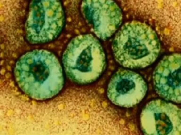 Aumenta a 282 las muertes por virus del MERS en Arabia Saudita