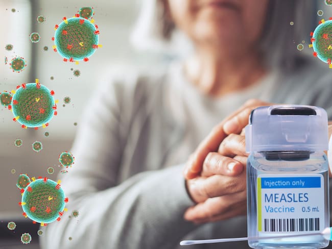 Vacuna contra el sarampión: ¿Por qué los adultos de más de 50 años no son un grupo prioritario?