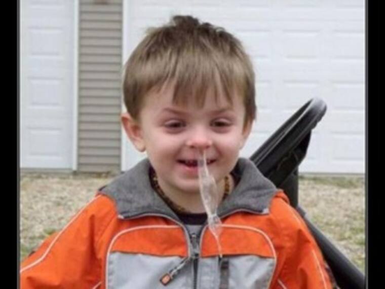 ¿Por qué los niños producen más moco que los adultos?