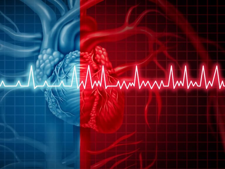 Fibrilación auricular: ¿la nueva epidemia cardiaca?