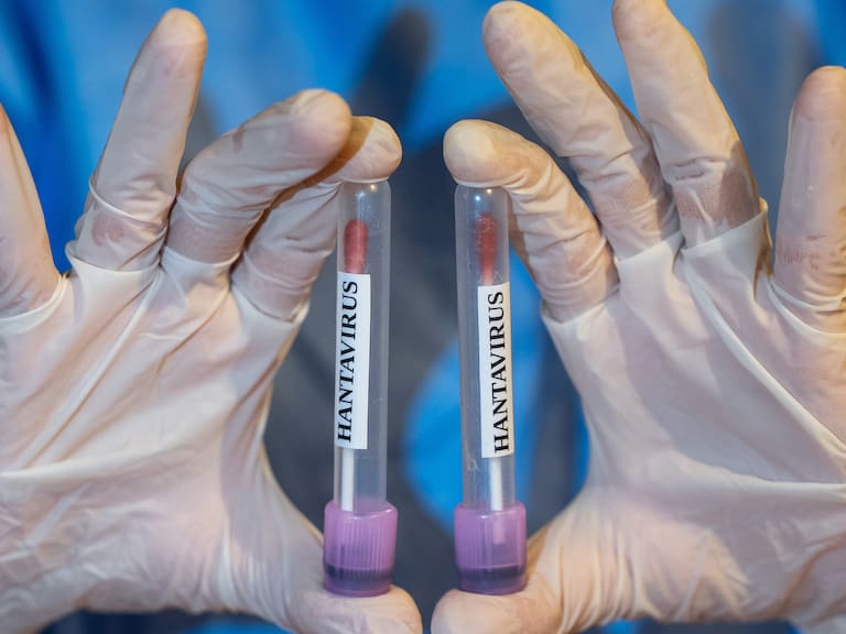 Hantavirus: qué tan mortal es realmente y por qué expertos insisten en detectarlo a tiempo (Photo by Arman Onal/Anadolu via Getty Images)