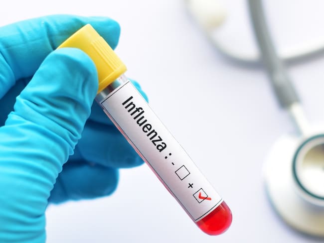 Lo que tienes que saber de la influenza