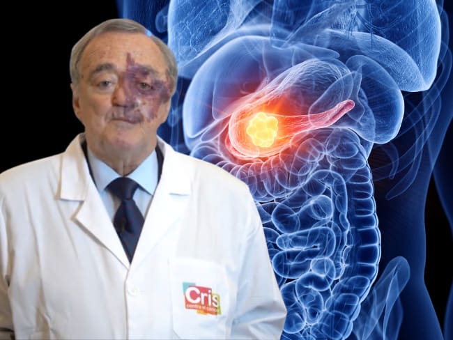 Mariano Barbacid vs cáncer de páncreas: La terapia del CNIO que elimina tumores sin efectos secundarios