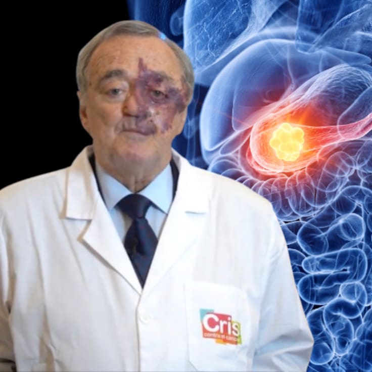 Mariano Barbacid vs cáncer de páncreas: La terapia del CNIO que elimina tumores sin efectos secundarios