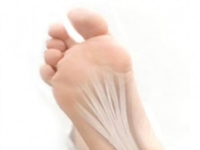 Fascitis Plantar.'Runners' con Sonia Chavez