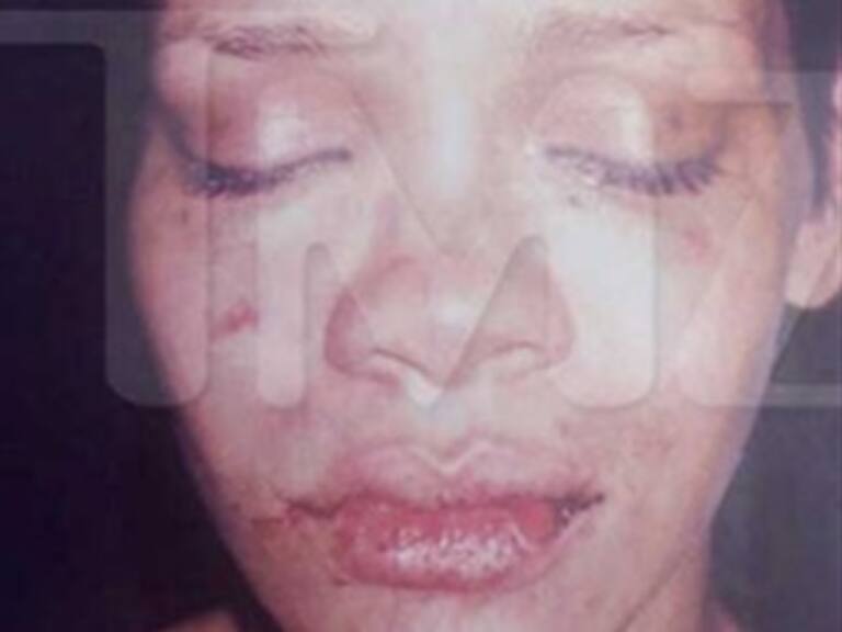 Publica TMZ supuesta foto de Rihanna golpeada