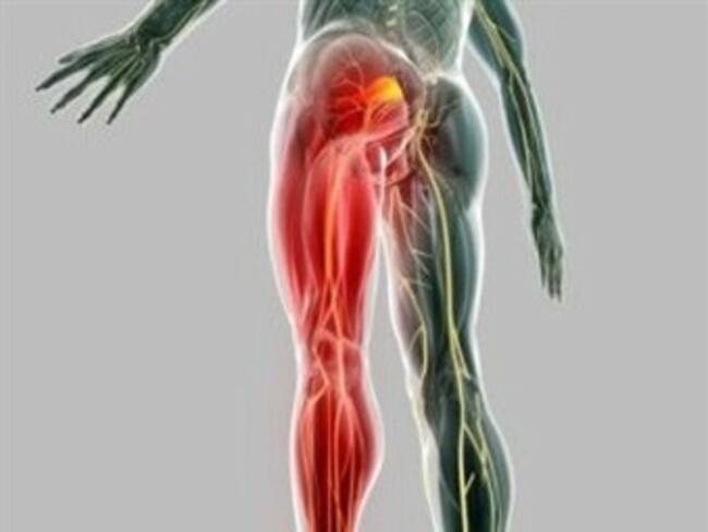 "¡Me duele la ciática!"