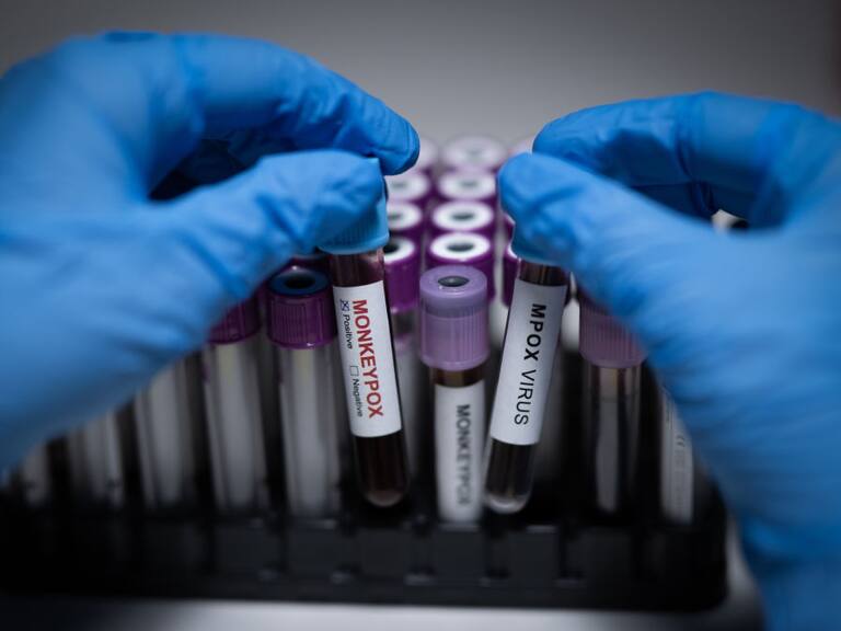 ¿Cuándo llega la vacuna contra la viruela del mono en México?