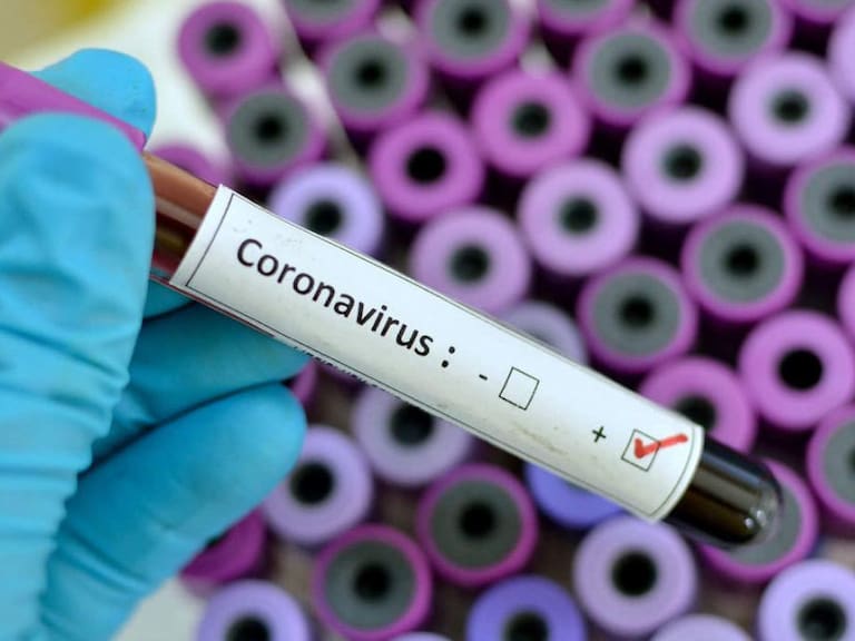 Lo que tienes que saber del coronavirus