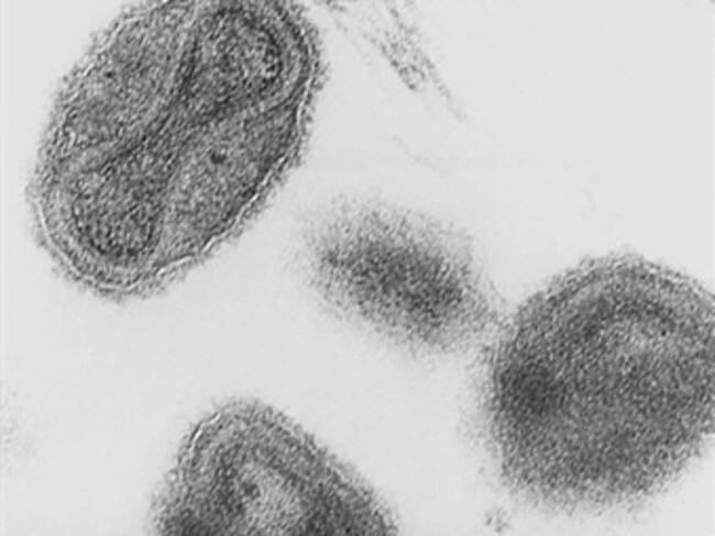 Descubren frascos abandonados con el virus de la viruela en EU