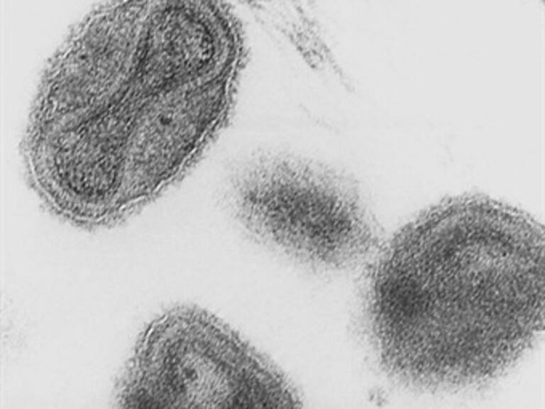 Descubren frascos abandonados con el virus de la viruela en EU