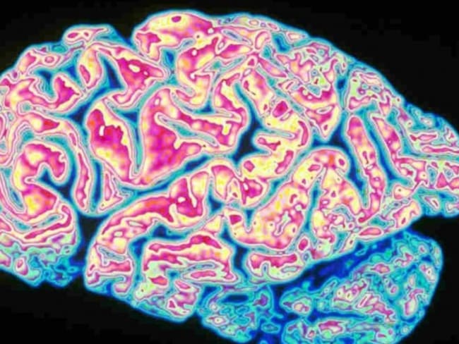 Buenas noticias contra el Alzheimer; científicos descubren cómo detener su avance