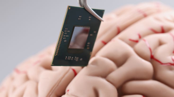 Un hombre ciego de 65 años recuperó la vista tras recibir un implante cerebral en España