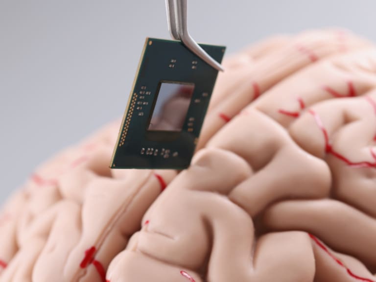 Un pequeño implante de cuatro milímetros instalado en la base del cerebro permitió que un hombre de 65 años volviera a distinguir formas y luces tras tres años de ceguera.