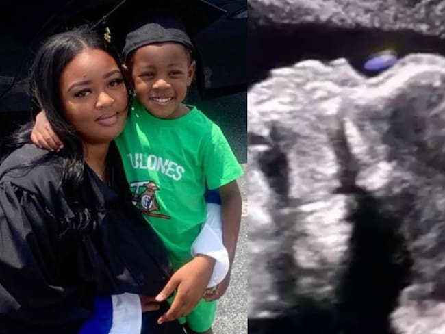 ¿Quién es Adriana Smith, la mujer con muerte cerebral conectada a soporte vital por su embarazo en Georgia?