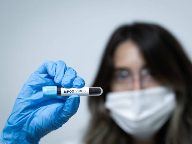 Alertan por aumento de casos de mpox o ‘viruela del mono’ en el Festival de playa de Zipolite