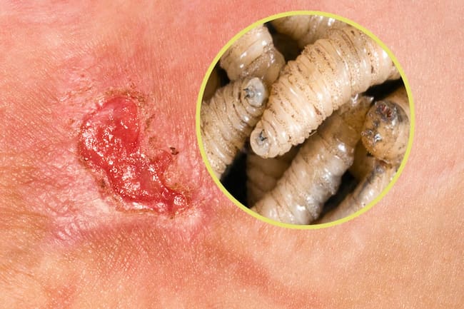 gusano barrenador miasis